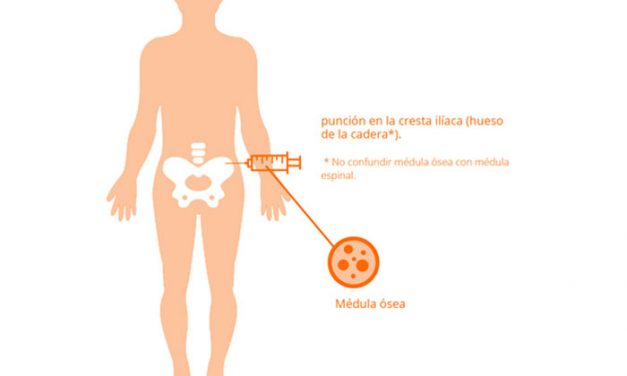 Hola, tenemos un pequeño amigo que necesita un trasplante de médula