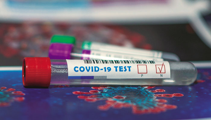 Test de autodiagnóstico de anticuerpos frente al Sars-cov-2 en farmacias