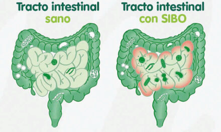 No todo es SIBO