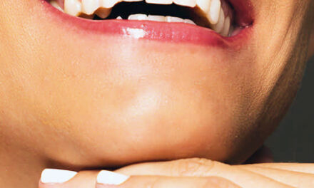 ¿Qué es mejor, dientes naturales o implantes?